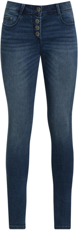 Damen Slim-Jeans mit Knopfleiste (Nur online)